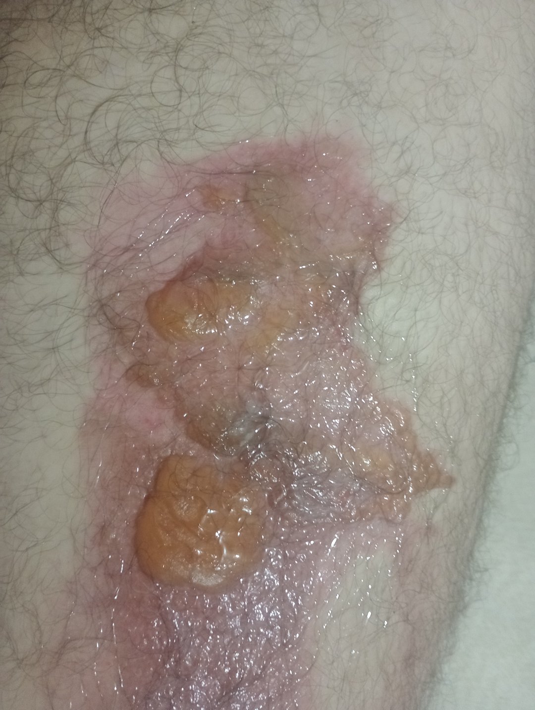 Recuperação do meu esposo