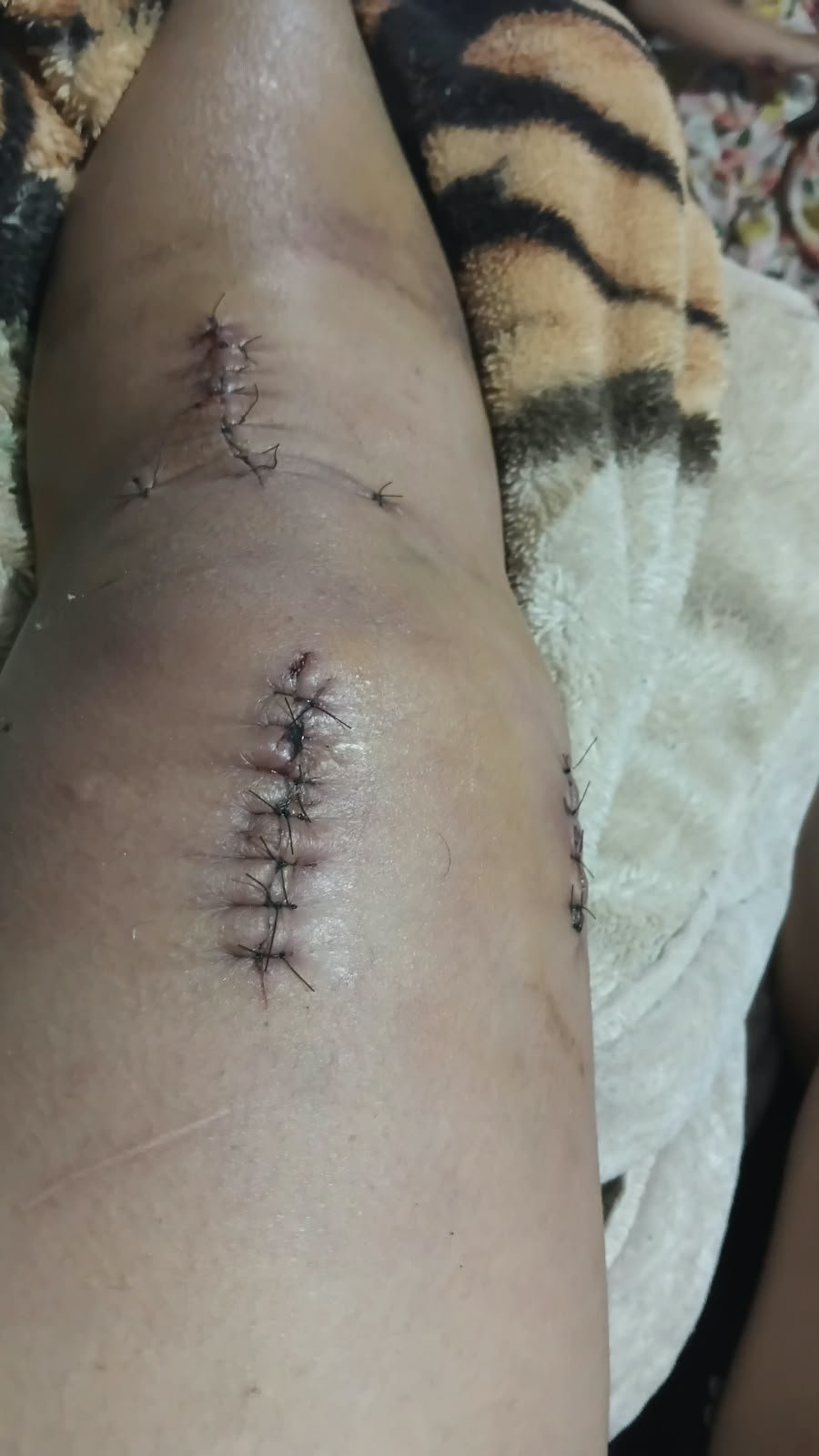 Cirurgia de joelho
